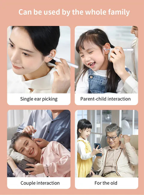 Wireless Otoscope Ear Wax Remover – safe, precise and gentle on the ears 🦻✨