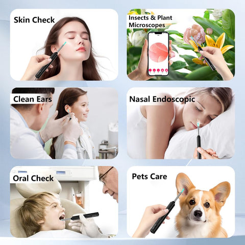 Wireless Otoscope Ear Wax Remover – safe, precise and gentle on the ears 🦻✨