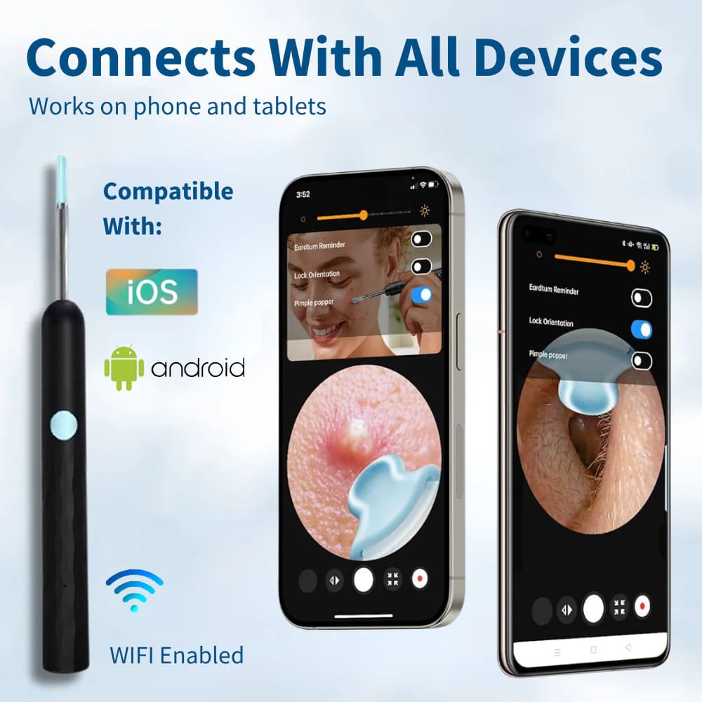 Ear Wax Removal Tool with 1080P HD Camera – Wireless Otoscope Ear Cleaner for Android & iPhone